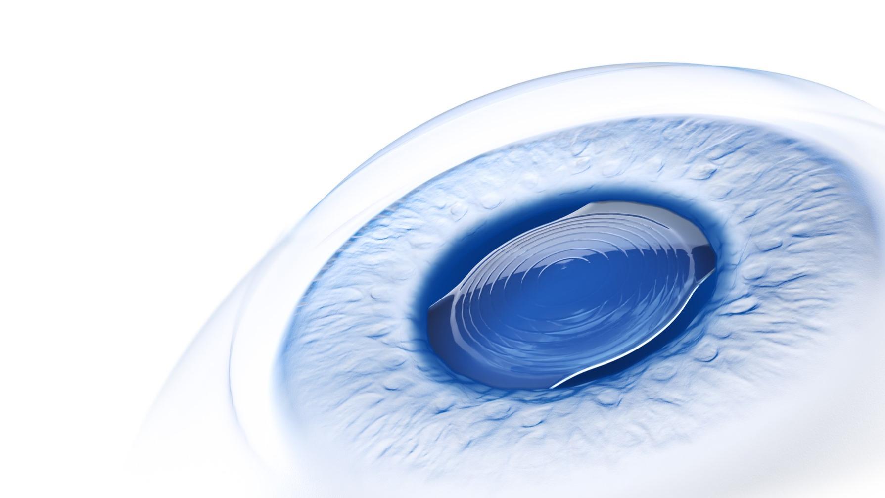 ZEISS launches NEW AT LARA EDoF in Canada