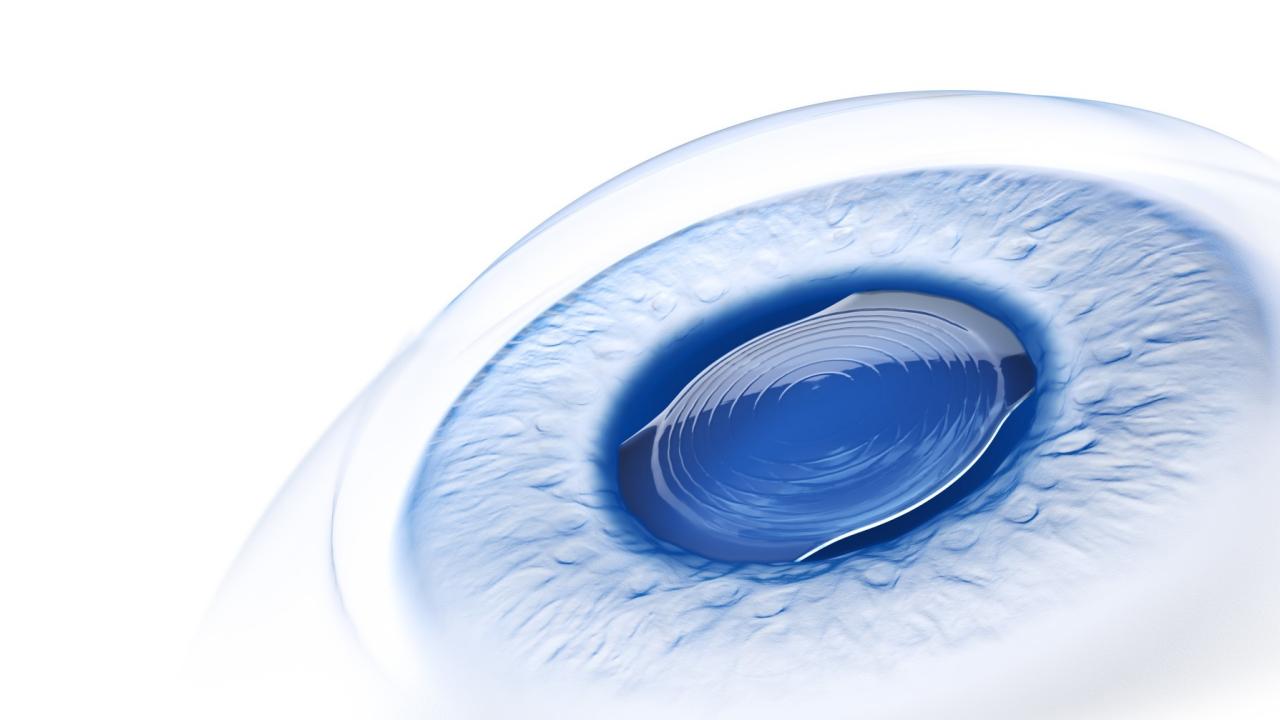 ZEISS IOLs Portfolio Canada