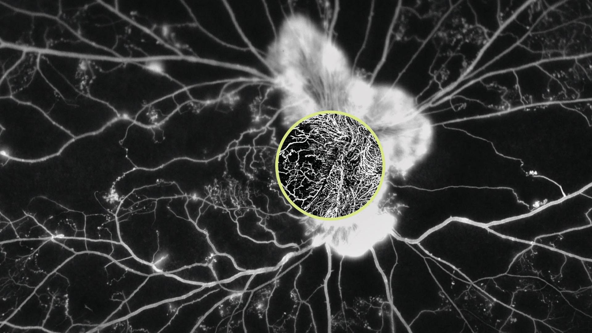 Revolutionize your practice with OCT Angiography