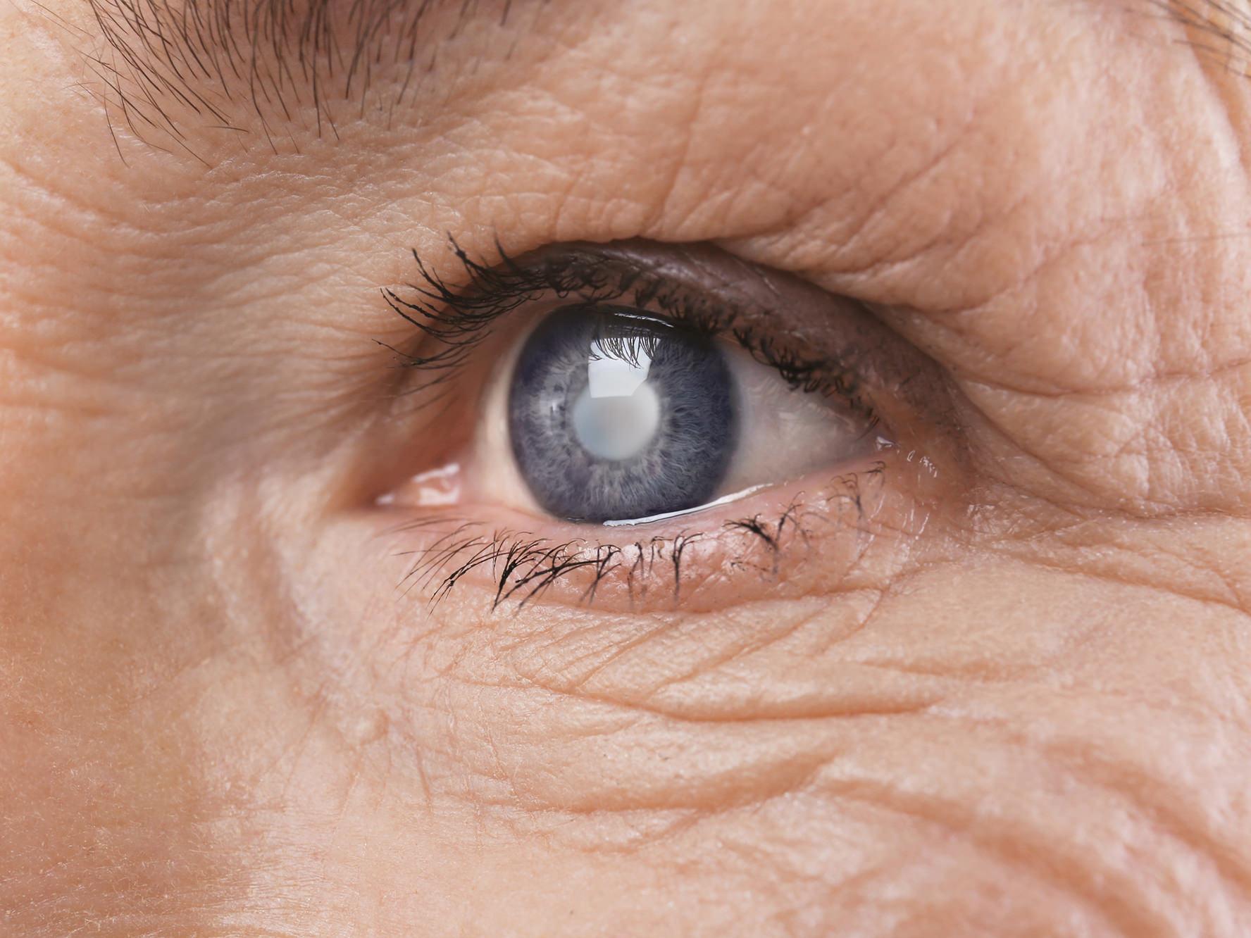 The image shows a close-up of an unhealthy eye, illustrating potential ocular adnexa hazards. 