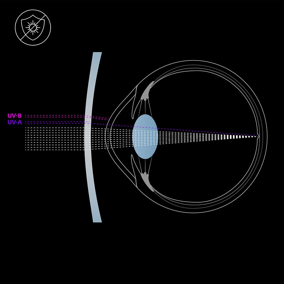 Illustration de l’œil et d’un verre sans protection UV qui transmet des rayons de lumière UVA et UVB à l’œil.  