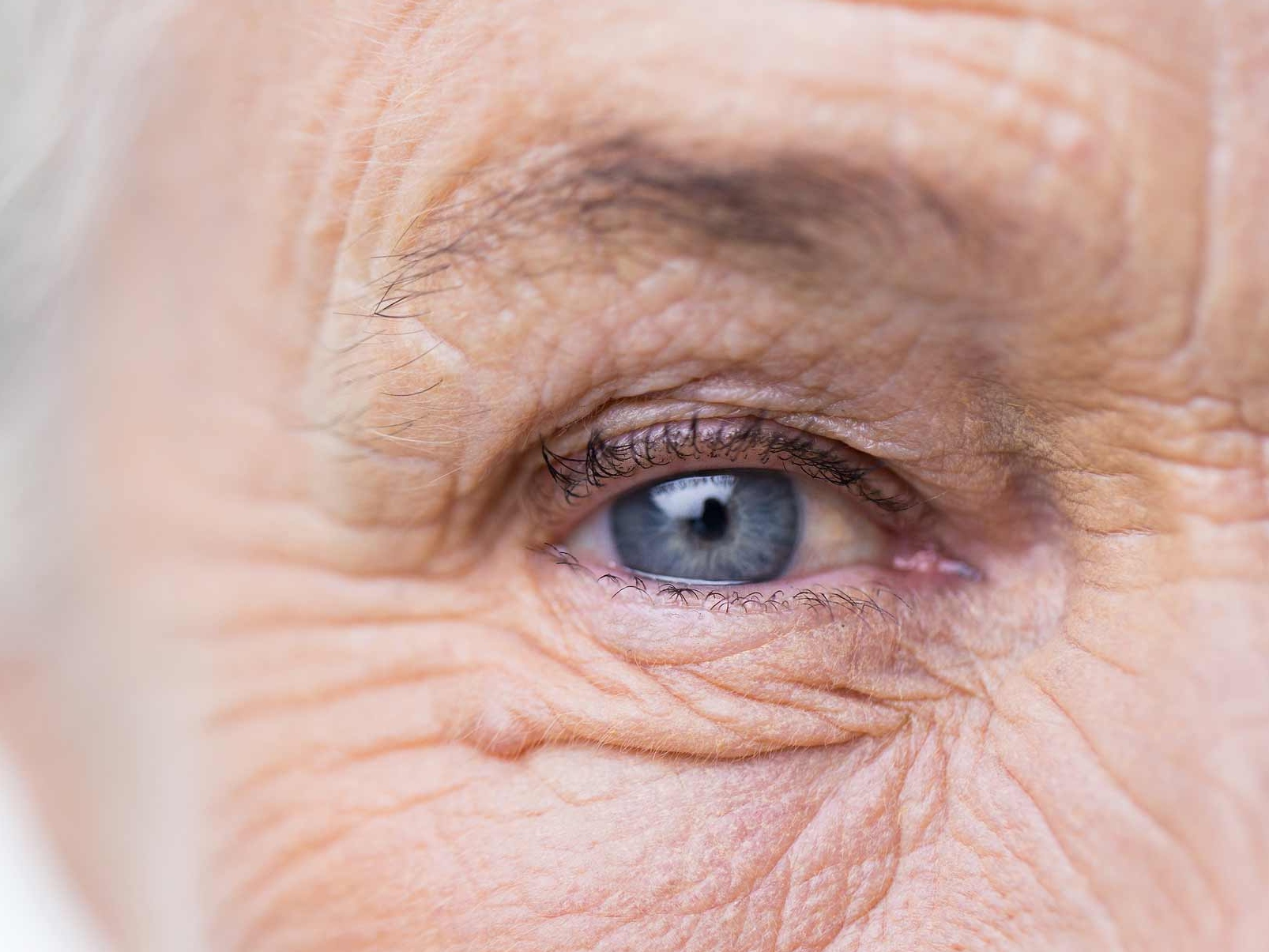 L’image montre un gros plan d’un œil malade pour illustrer l’apparition de risques potentiels pour les annexes oculaires. 