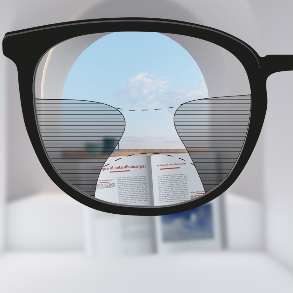 An image slider showing a conventional multifocal lens on the left, with relatively limited viewing zones, compared to a premium lens on the right that has clear vision through more of the lens.